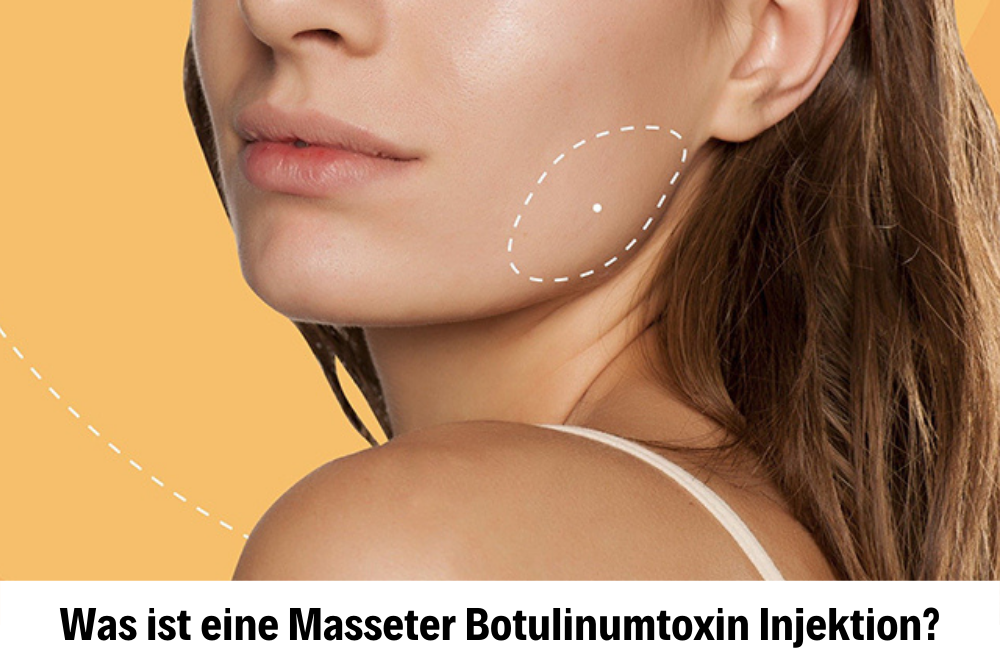 Masseter Faltenbehandlung